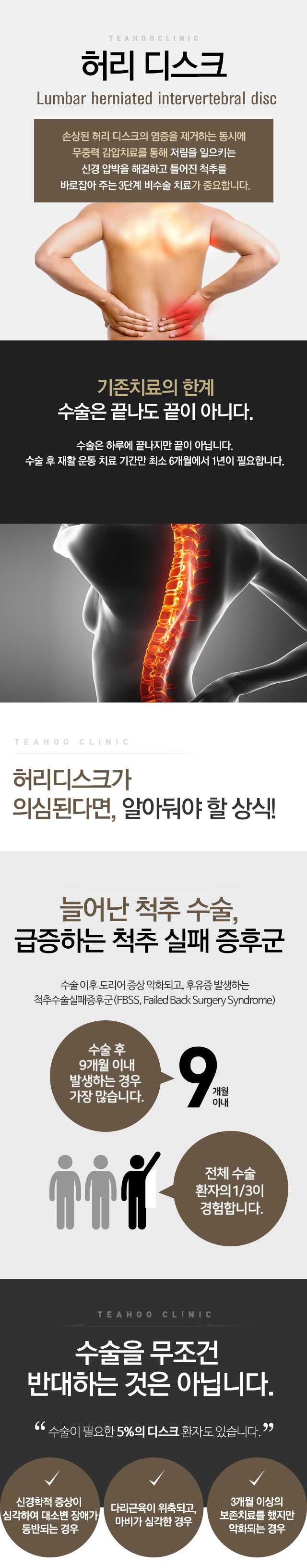 허리디스크