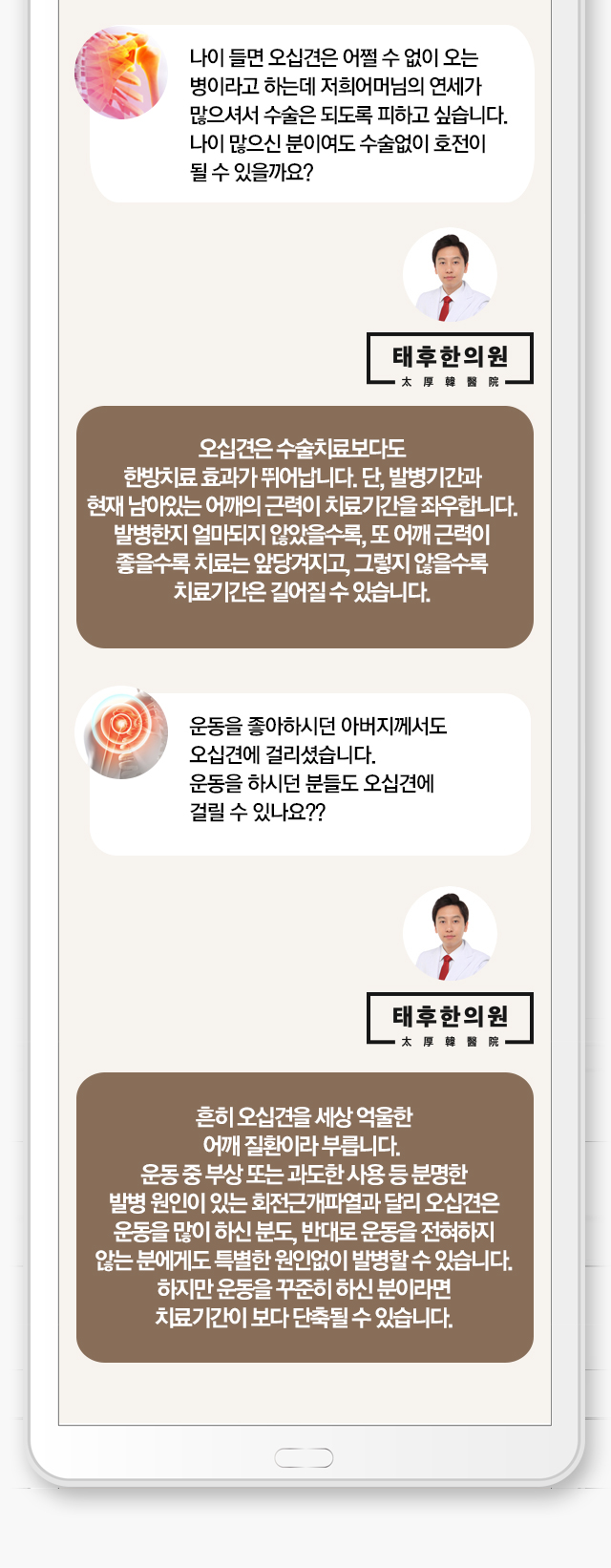 회전근개파열