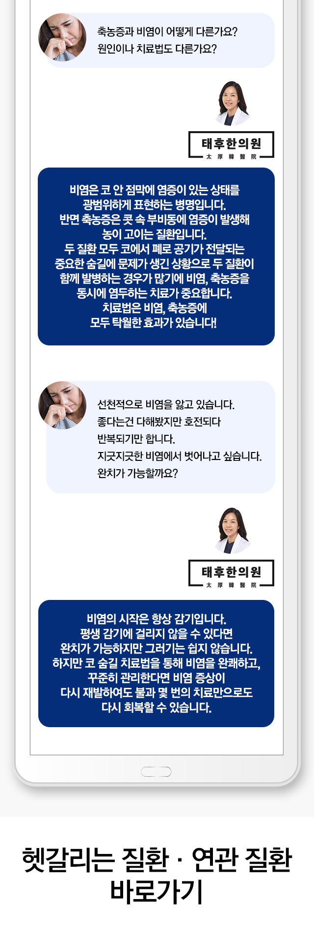 비염