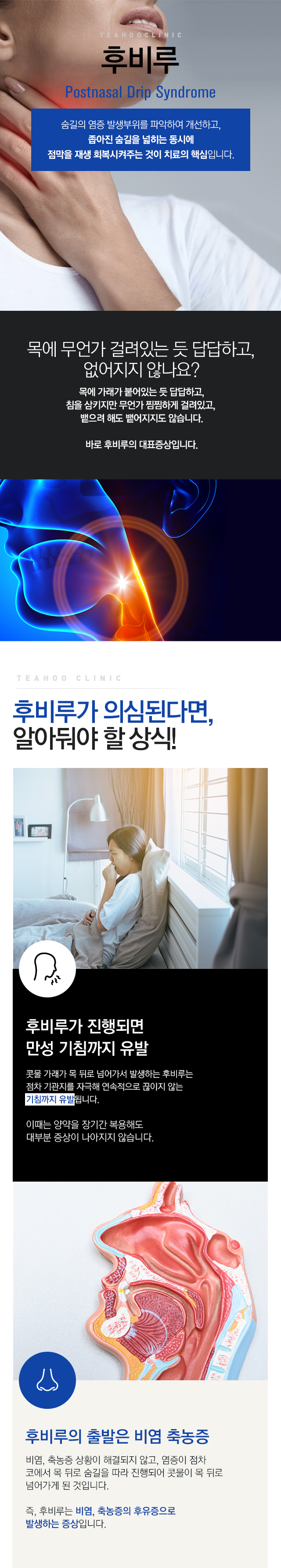 후비루