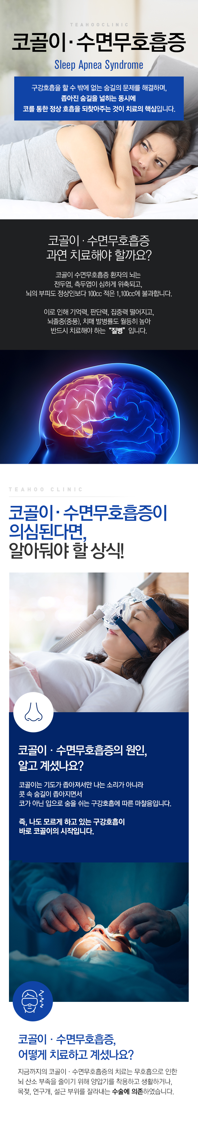 코골이 수면무호흡증