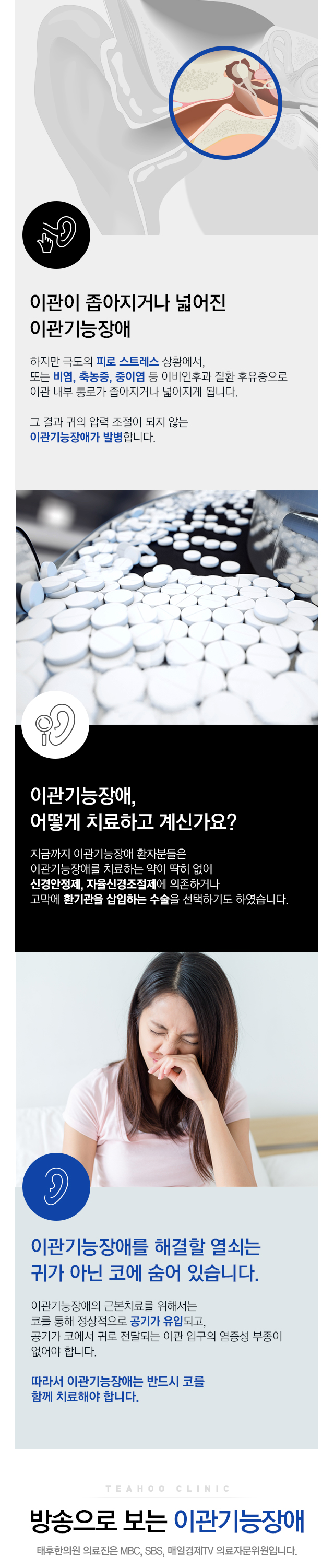 이관협착증