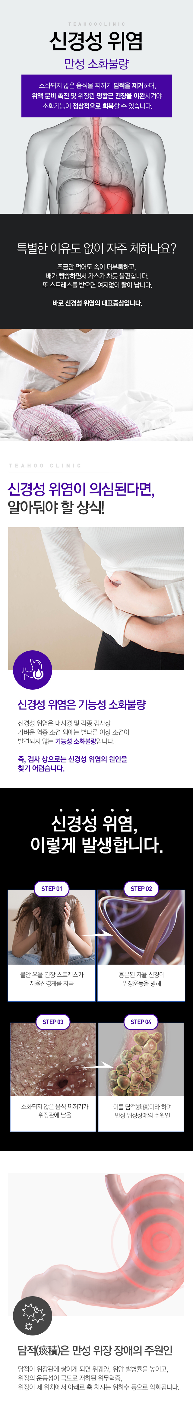 신경성위염