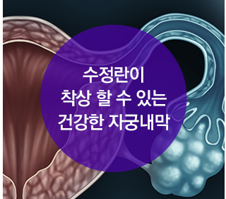 난임