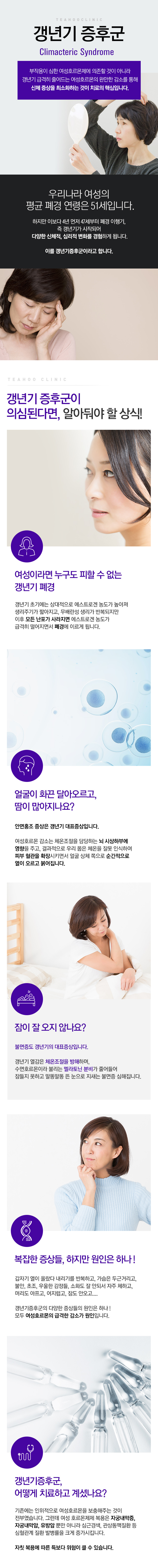 갱년기증후군